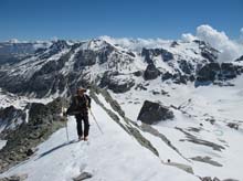 Rognosa_Etiache_gengiva_15_51a